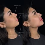 @natural_facial_contouring profile picture