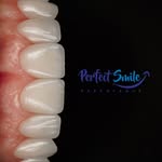 @perfectsmileexperience profile picture